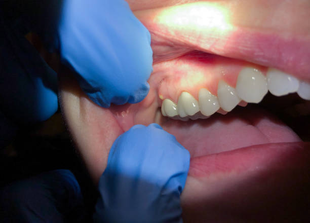Best Emergency TMJ Treatment in Salina, KS