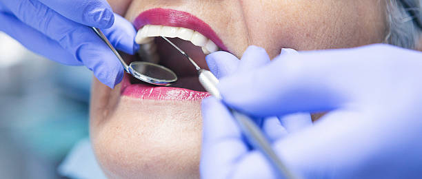 Best Emergency Wisdom Teeth Removal in Salina, KS